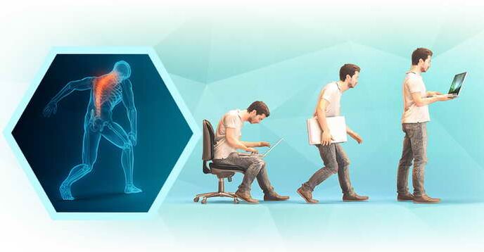 schlechte Körperhaltung bei der Arbeit am Computer und thorakale Osteochondrose