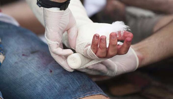 Traumatische Verletzung der Hand, begleitet von Schmerzen in den Fingergelenken